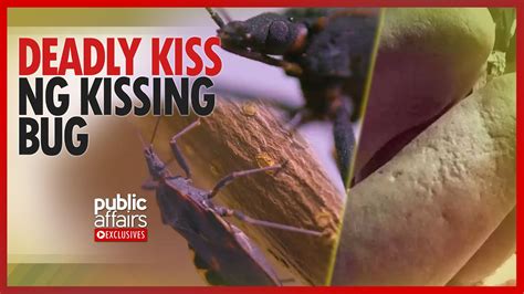 kissing bug in tagalog|Deadly kiss ng kissing bug .